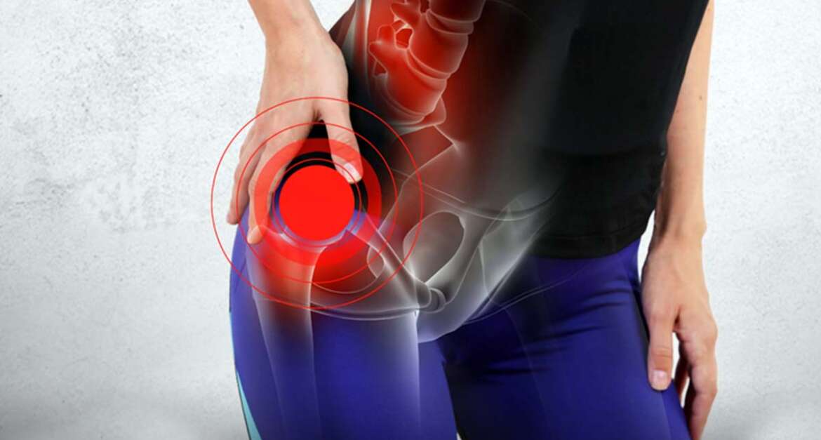 Hip Replacement Surgery